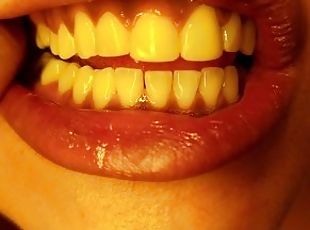 Mouth, teeth, tongue and uvula check (Short version)