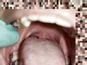 Uvula fetish